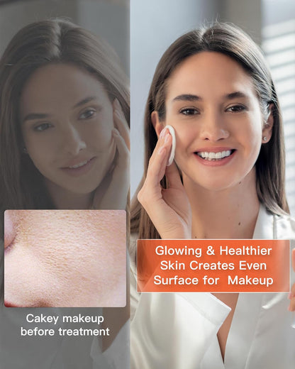 GlowBoost LED Facial Mask™