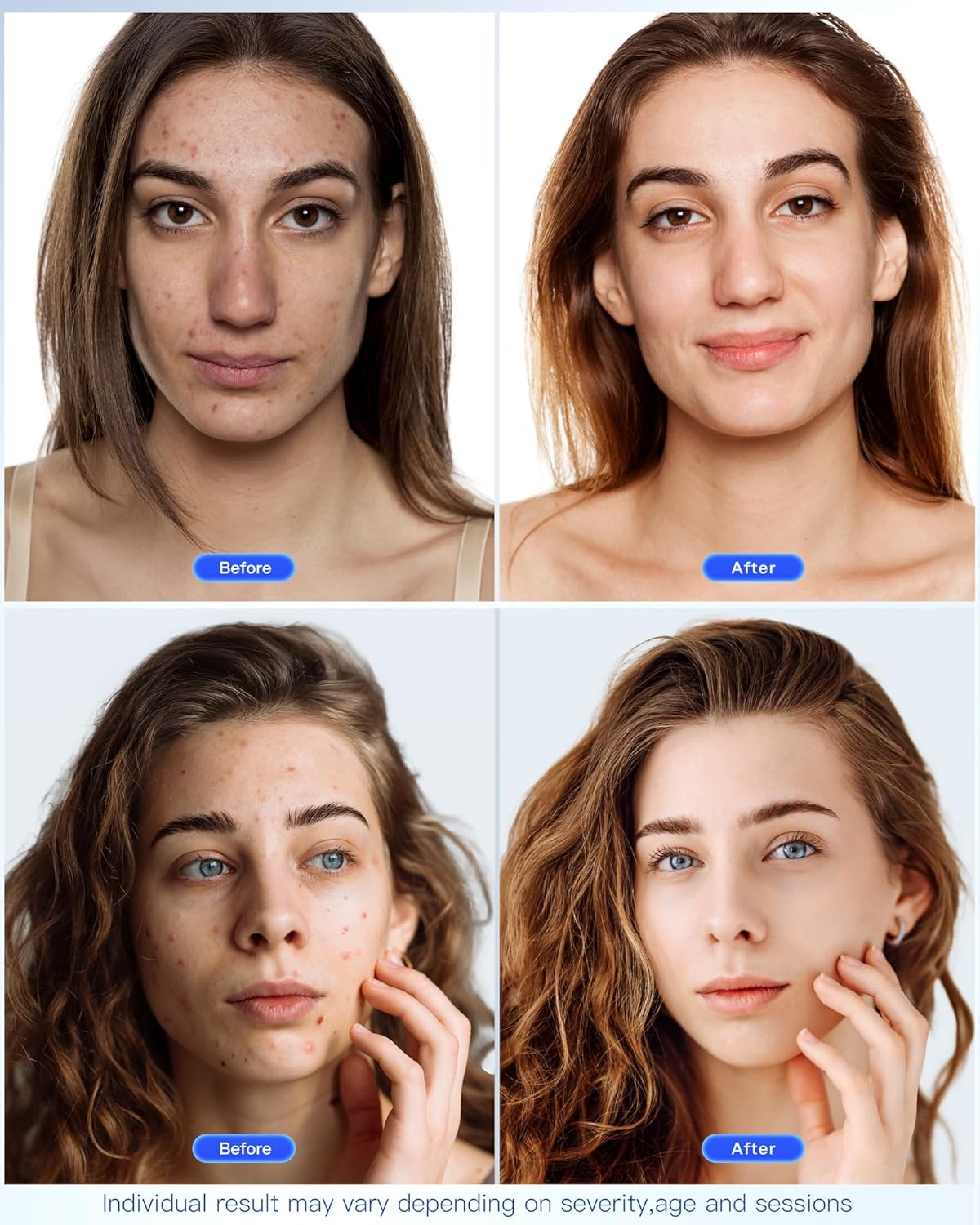 GlowBoost LED Facial Mask™