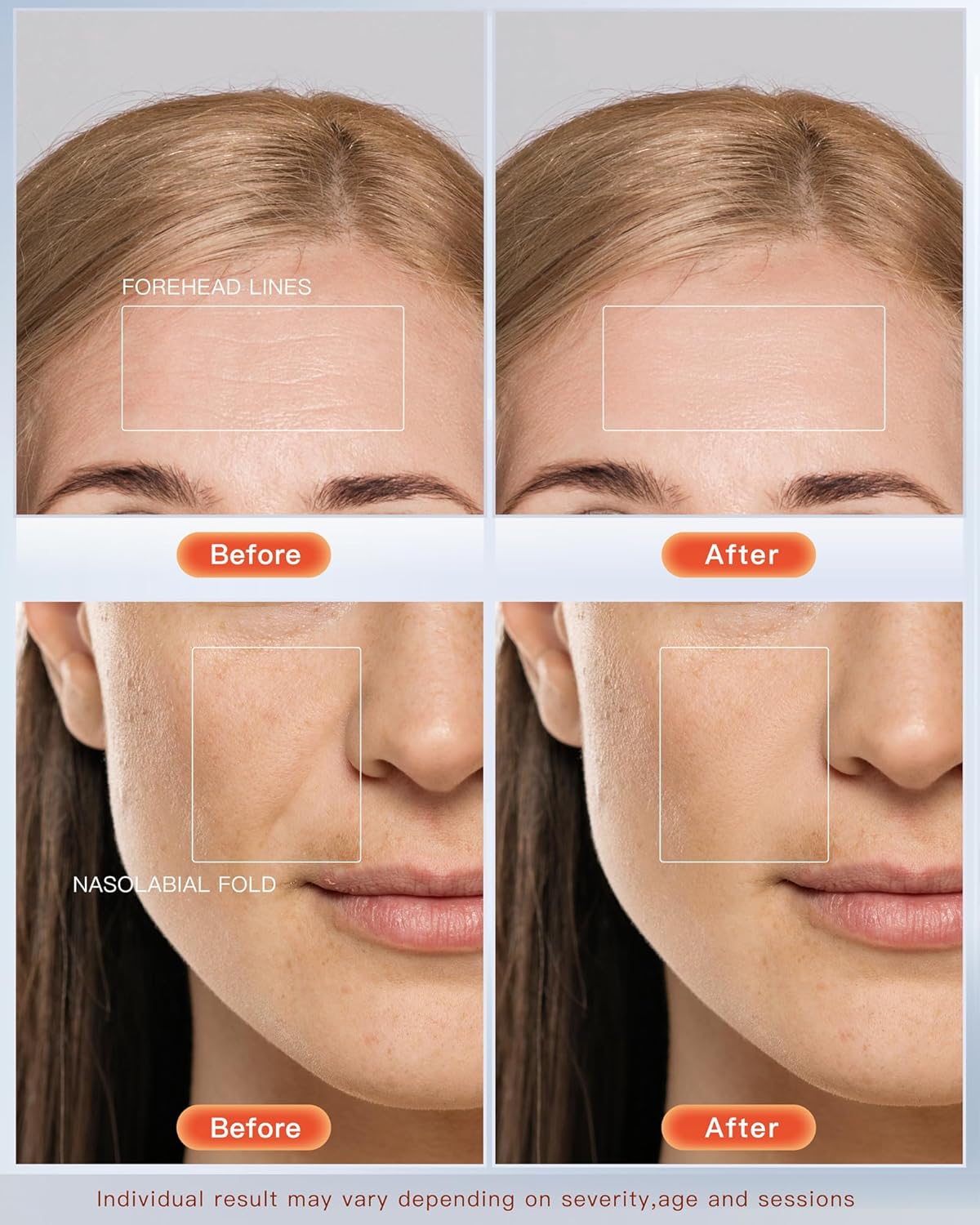 GlowBoost LED Facial Mask™